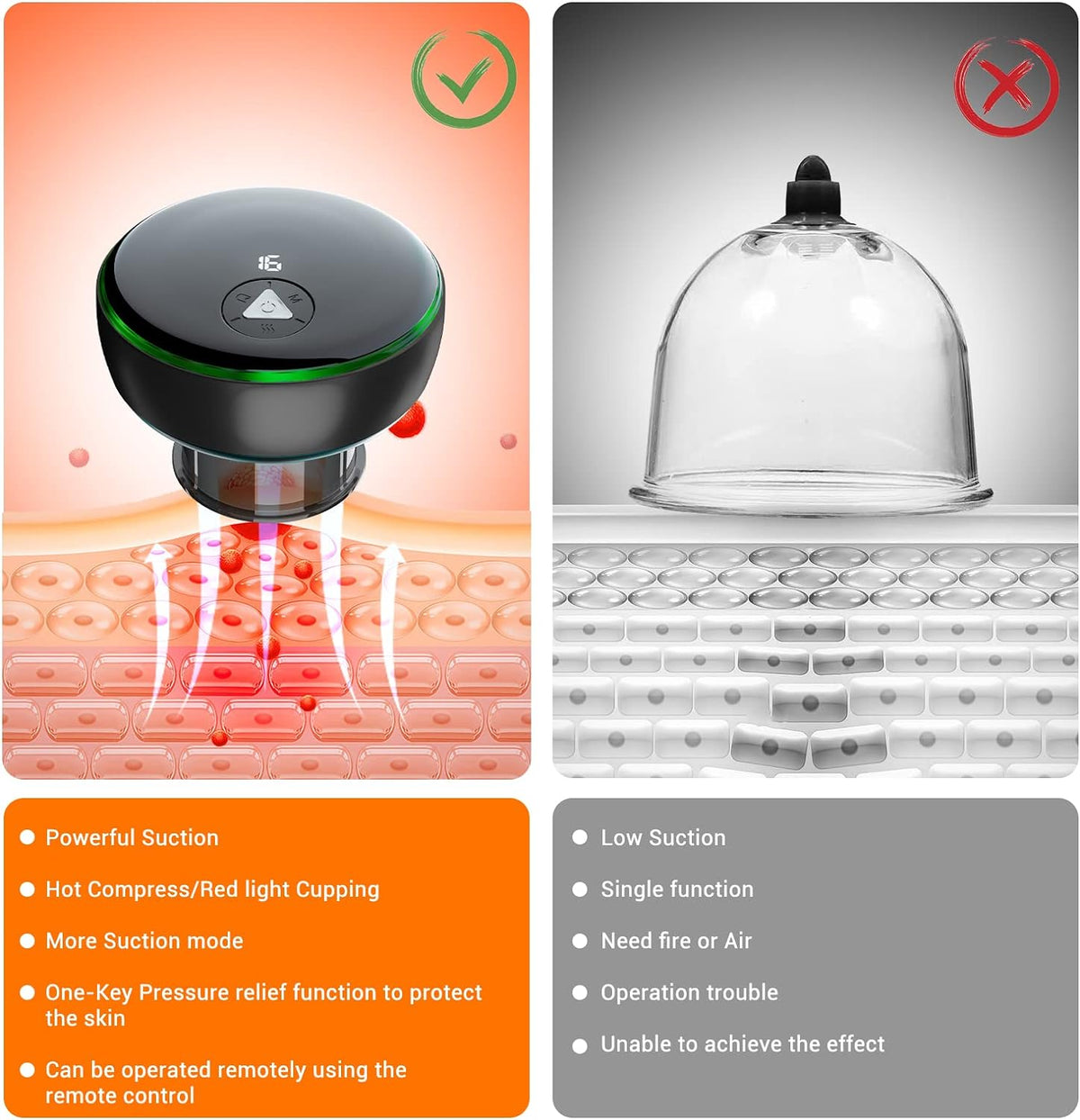 Cupping Control Kit Electric Smart Cupping Therapy Set,5 in 1 Remote Control Cupping Set w ...